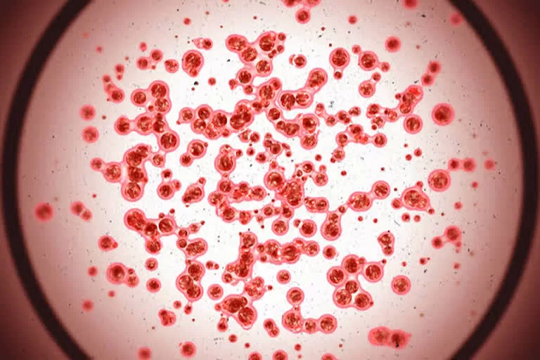 Doctors shed light on how CAR-T therapy differ from traditional cancer treatments such as chemotherapy and radiation?