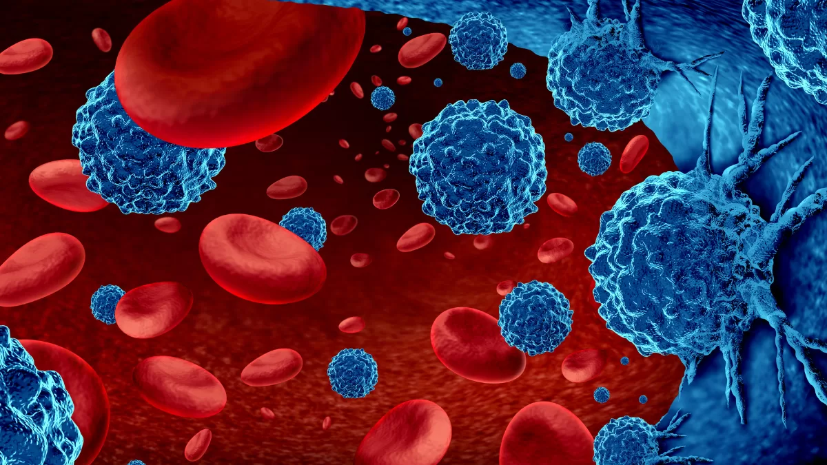 Doctors shed light on how CAR-T therapy differ from traditional cancer treatments such as chemotherapy and radiation?
