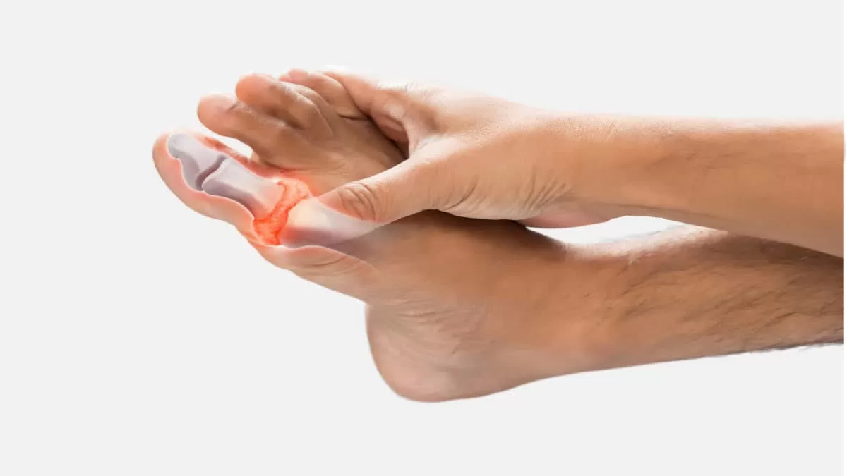 These things will remove all the uric acid deposited in the blood and joints, you will also get relief from arthritis