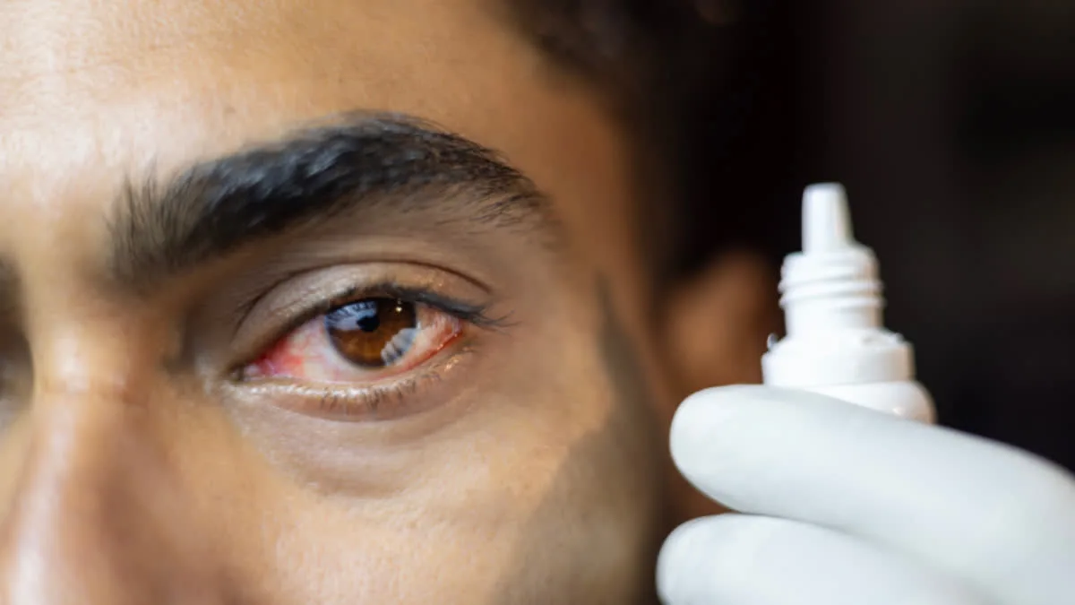 Is high uric acid really a threat to eye health? Learn about its symptoms.