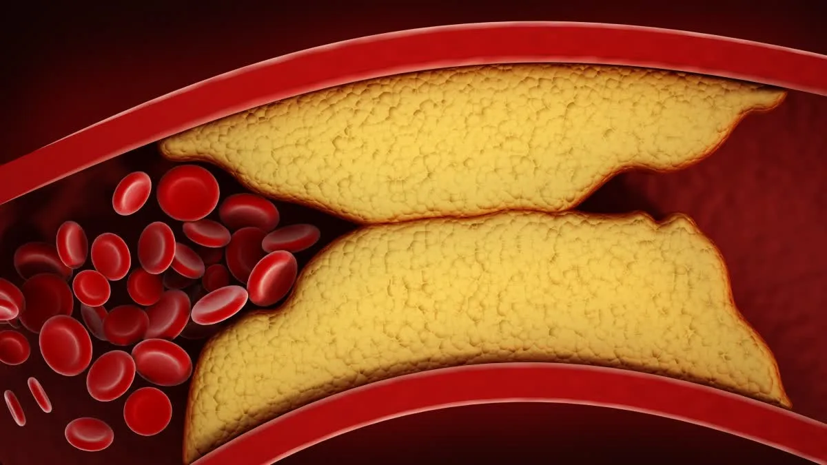 What changes occur in your body when your cholesterol levels rise?