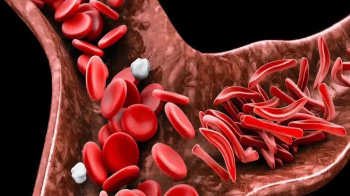 blood count increase naturally without supplements? Learn what to eat to prevent anemia.