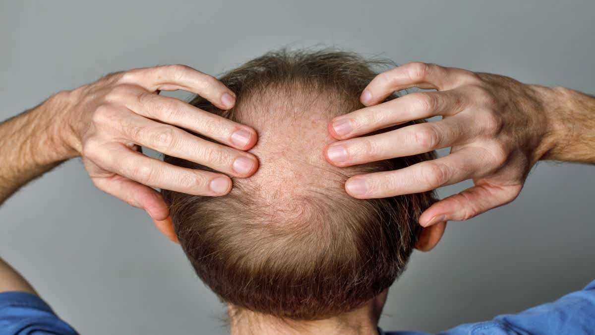 What causes excessive hair loss, and which 5 blood tests can help identify the cause?