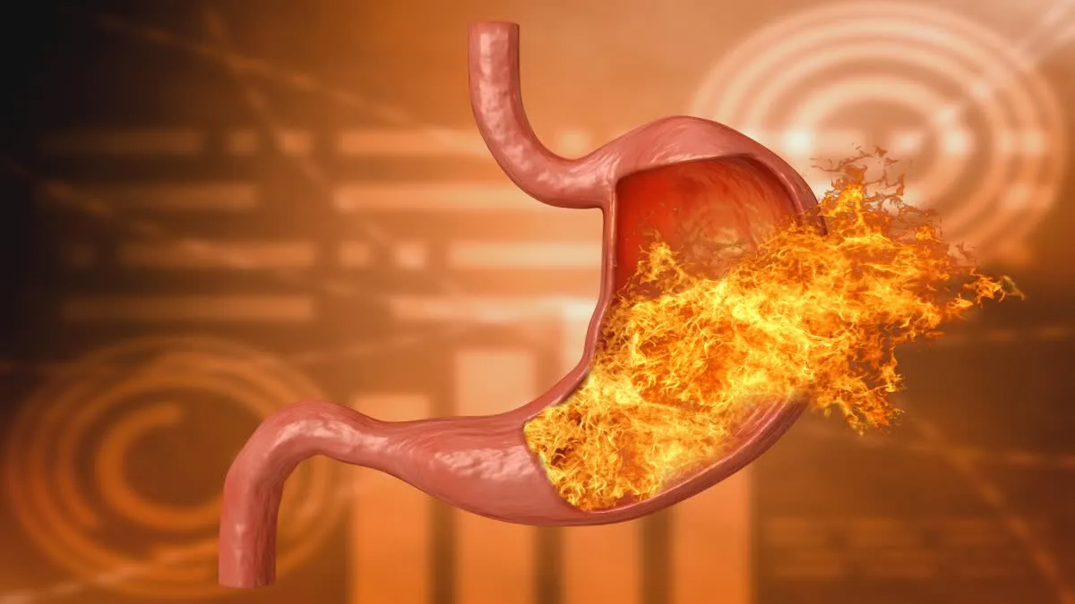 Are you troubled by stomach problems associated with GERD