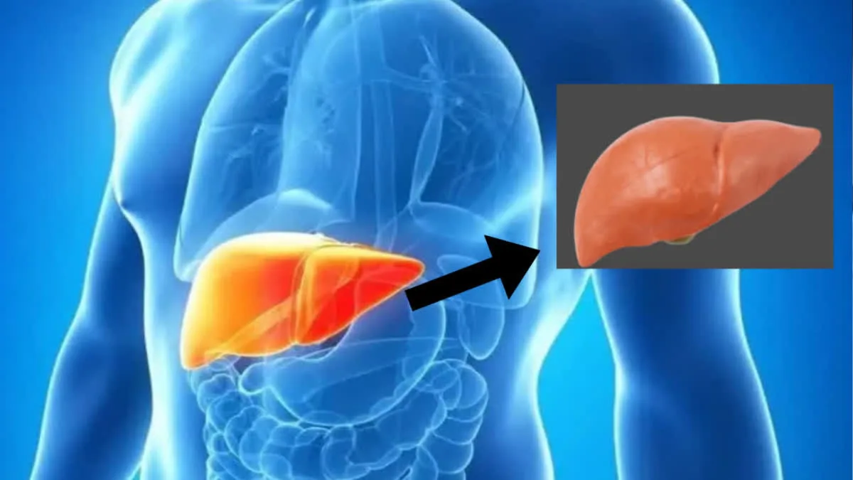 A GGT test can detect any problems or diseases in the liver or bile ducts. Learn how?