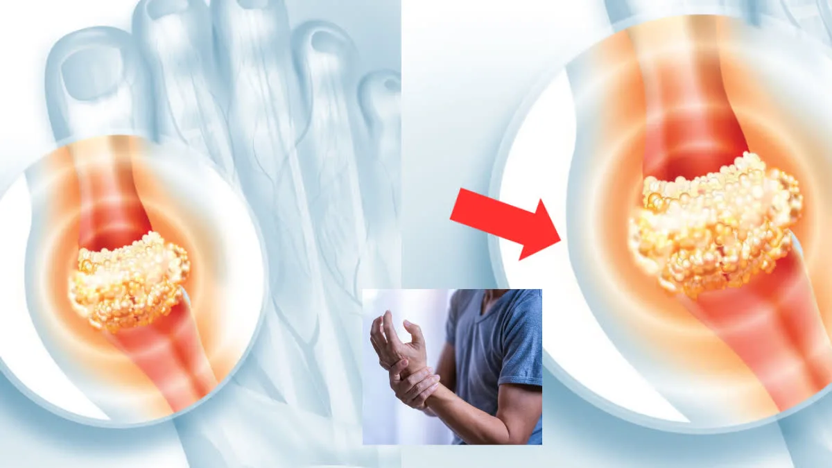 Are your uric acid levels still not reducing despite giving up red meat and protein? Here's the real reason.