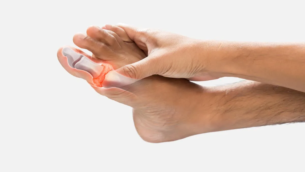 Experiencing pain in the hands, feet, and joints immediately upon lying down is a symptom of a uric acid problem.