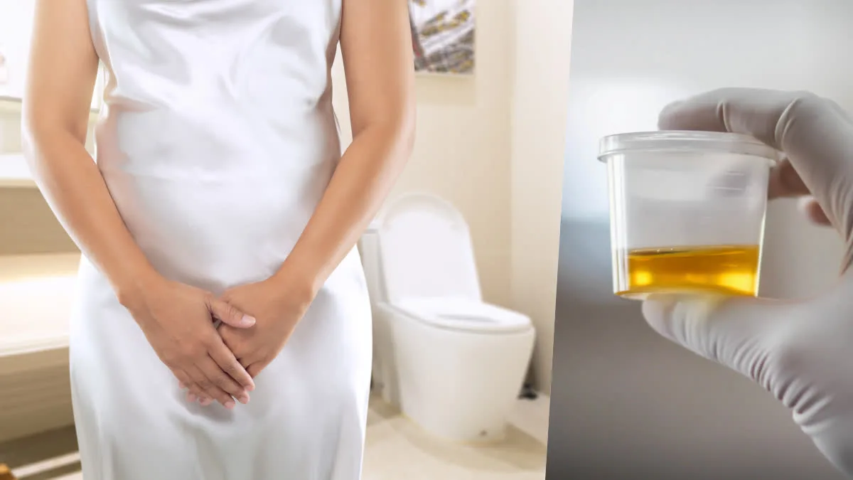 Do you notice swelling in your eyes or feet when you wake up in the morning? These are symptoms of Nephrotic Syndrome!