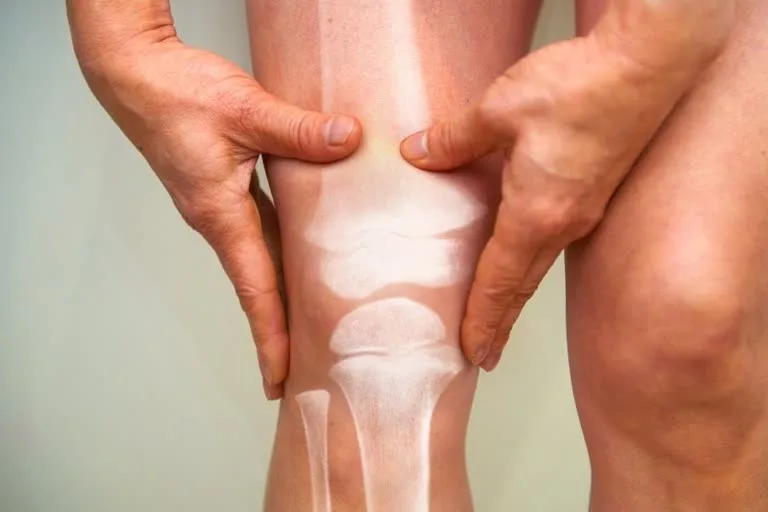 Why is the problem of osteoporosis and low bone density increasing among younger men?